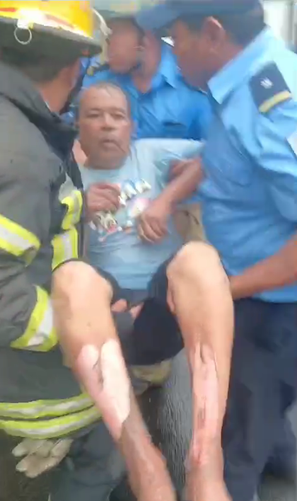 Un anciano se quemó al incendiarse su vivienda en el barrio El ...